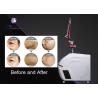 Buy cheap 1-10HZ ND YAG Laser Machine Skin Rejuvenation 2-10mm Spot Diameter from wholesalers