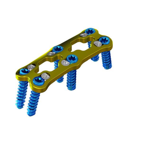 Buy cheap Titanium Vertebra Spinal Anterior Cervical Fixation For Surgery from wholesalers