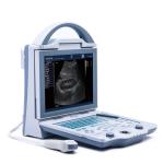 Diagnostic Medical Ultrasound Machine KX5600 Ultrasound Machine Full Digital B