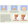 Buy cheap Permanent 808nm Diode Laser Hair Removal leadbeauty from wholesalers
