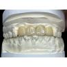 Buy cheap Stain Resistant All Porcelain Bridge Comfortable Fit For Dental Restoration from wholesalers