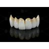Buy cheap High Translucency Full Contour Zirconia Bridge Chipping Resistance Natural Esthetics from wholesalers