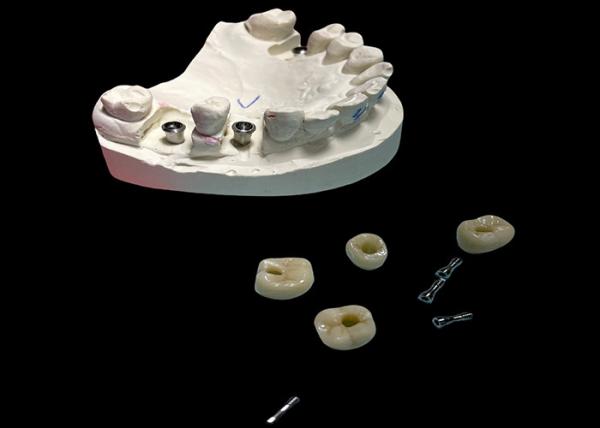 Buy cheap Polished Surface Dental Implant Screw Retained Crown For Tooth Replacement from wholesalers