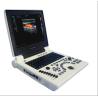 Buy cheap 4D Color Ultrasound Portable Ultrasonography Machine Digital from wholesalers