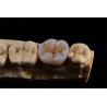 Buy cheap Layered Zirconia Crown for Natural Aesthetics from China Dental Lab from wholesalers