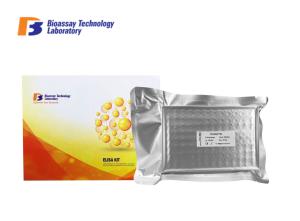 Wholesale SOCS Box Protein 2 Sandwich ELISA Kit 2 Hours Assay Length Human High Sensitive Ankyrin Repeat from china suppliers