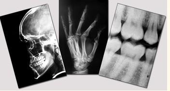 Buy cheap Blue Medical Dry Imaging Film , 11in x 14in Laser Fuji X Ray Film from wholesalers