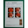 Buy cheap PET Based 125um 150um 180um Medical Dry Film White Inkjet X Ray Film OEM from wholesalers