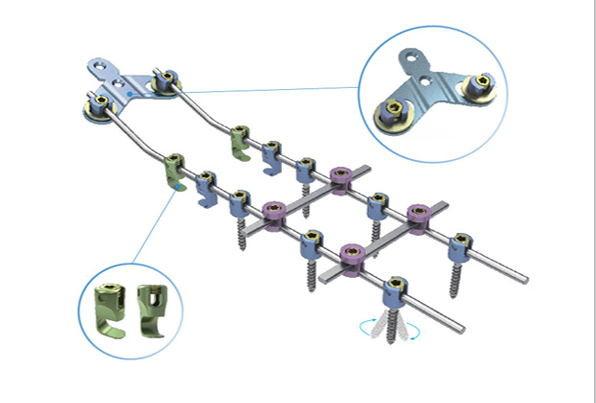 Buy cheap Posterior Cervical Internal Spine Fixation System , Pedicle Screw System from wholesalers