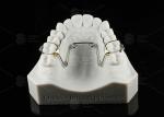 Children And Adolescents Quad Helix Appliance Orthodontics Stainless Steel