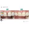 Buy cheap Ceramic For Natural Aesthetics Dental Veneers Stain Resistance Maintains Brightness Strong Bond With Tooth Enamel For Secure Fit from wholesalers