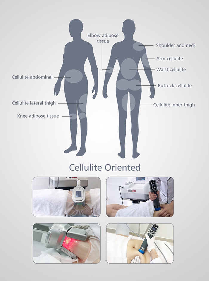 Salon Cryolipolysis Fat Freezing Machine With Shock Wave