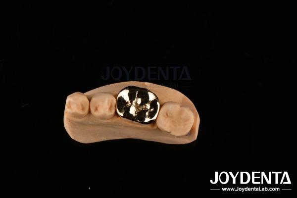 Buy cheap Metallic FMC Oral Clinical Repair Dental Implant Materials with Abrasive Resistance from wholesalers