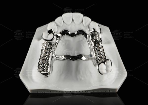 Buy cheap Repairable Cobalt Chromium Dental Metal Framework Partial Denture from wholesalers