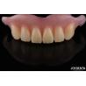 Buy cheap Natural Looking Dental Complete Denture Odor Resistant Adjustable For Proper Fit from wholesalers