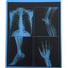 Buy cheap 25cm X 30cm Blue Transparency PET Thermal Film Medical Dry Imaging Film For Hospital from wholesalers