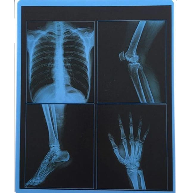 204±8 μM Thickness Medical Dry Film With High Durability ≤20% Haze UV Resistance