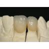 Buy cheap Smooth Surface PFM Metal-Ceramic Crown Corrosion Resistant from wholesalers