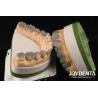 Buy cheap Highly Accurate Temporary Dental Diagnostic Wax Up Customized 1-2mm Thickness from wholesalers