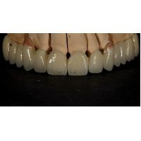 Buy cheap Good Fitting Good Esthetics Multi Layered Zirconia Crown Porcelain Zirconia product