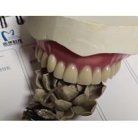 Buy cheap Complete Denture Permanent Esthetics Acrylic Partial Denture product