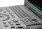 15-Inch Full Digital Color Doppler Ultrasound System