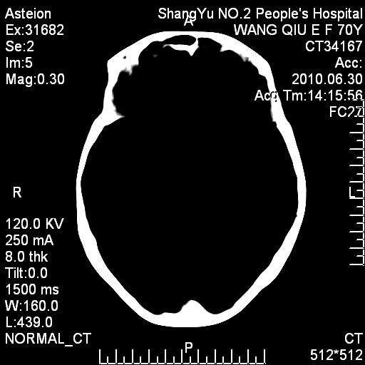 Quality Konida Digital X-ray Medical Dry Thermal Printer Film KND-A, KND-F for sale
