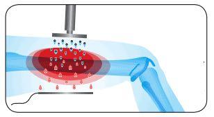 450khz 300W Medical Tecar Physical Therapy For Rehabilitation