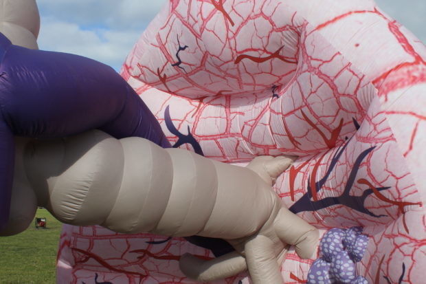 Giant Inflatable Lung Model Advertising For Medical Exhibition Events