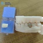 Aesthetic Zirconia Dental Restorations Zirconia Porcelain Crowns