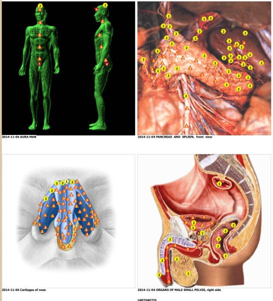 Quality Newest Metatron Hunter NLS System 4025 Bioresonance Health Scan and Therapy for sale