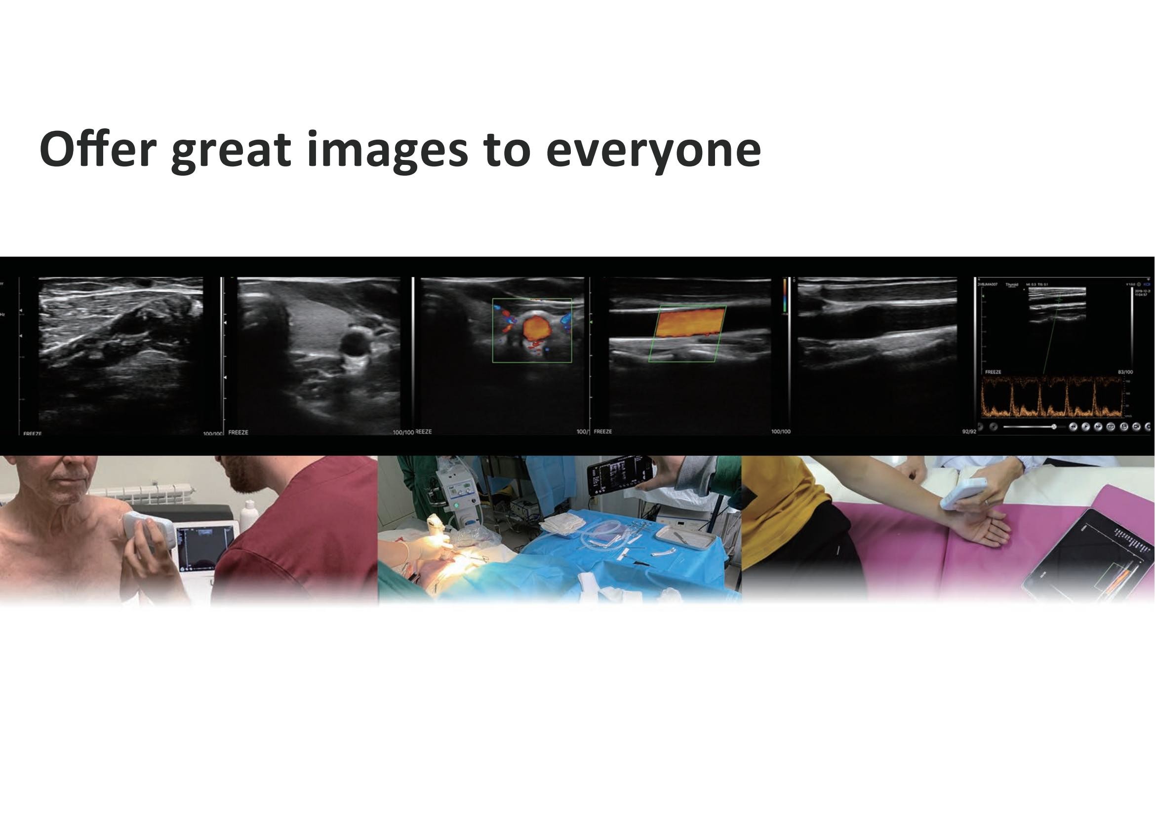 10mhz G10CX Medical Hospital Equipments Doppler Linear Wireless Probe Type Ultrasound Scanner