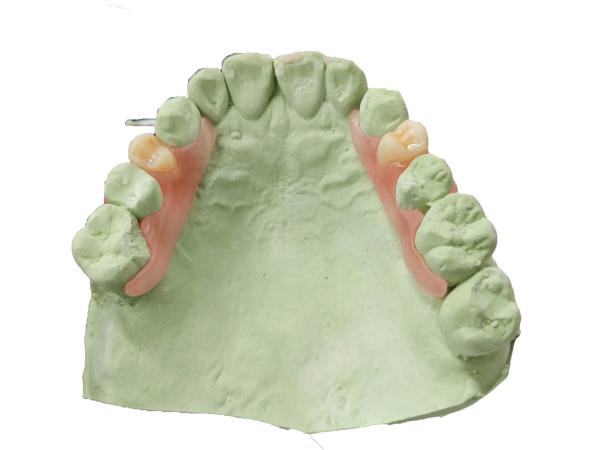 Safe and Comfortable Plant Reproduction Resin Customized Fit for Sensitive