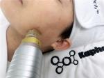 Skin Tightening AC110V 180W Microneedling Fractional RF