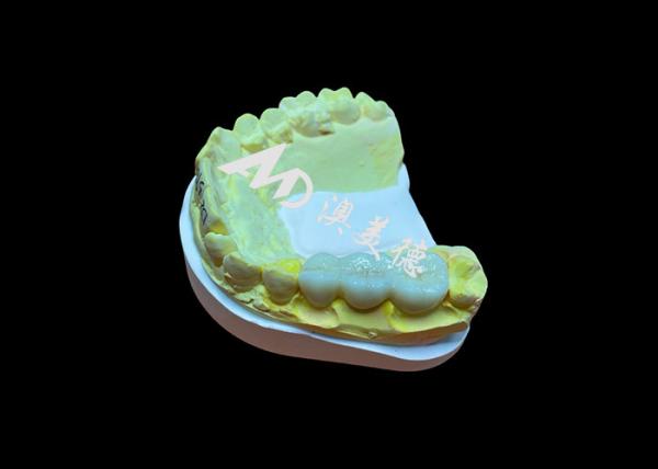 Buy cheap Customized Smooth Surface Zirconia Dental Crown High Biocompatibility Stain Resistance from wholesalers