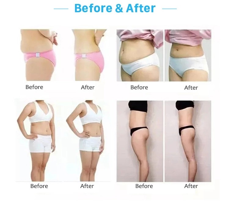 slimming massage ultrasonic beautiful multifunctional beauty body weight measuring instrument