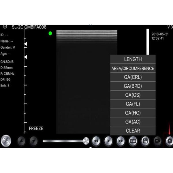 Buy cheap Wireless Usb Ultrasound Scanner Linear Convex Phased 3 IN 1 from wholesalers