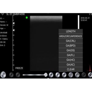 Buy cheap Wireless Usb Ultrasound Scanner Linear Convex Phased 3 IN 1 from wholesalers
