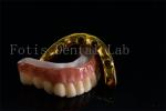 Buy cheap Affordable All On Six Dental Implants Effective Treatment Easy To Clean from wholesalers