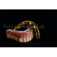 Buy cheap Affordable All On Six Dental Implants Effective Treatment Easy To Clean product