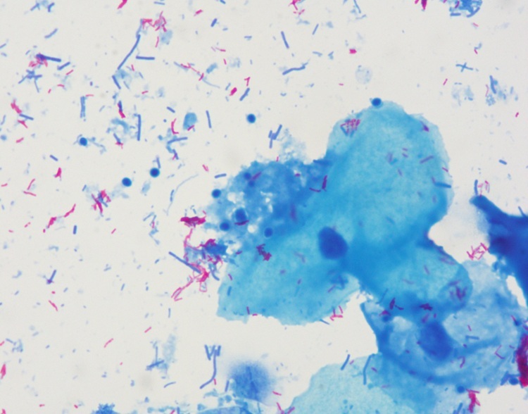 Clear Colourful Acid Fast Stain Reagents Phenol Free Fuchsin Staining Method For Auto Stainer