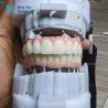 Buy cheap Layered Zirconia Implant Customization Full Arch Implant Cases from wholesalers