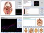 Original 9d Cell nls Full Body Health Analyzer 9d-nls With Russian/English