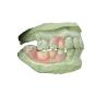 Buy cheap Flexible Denture Base Resin For Partially Edentulous Restoration Stable And Comfortable from wholesalers