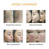 Buy cheap IPL OPT Diode Laser Hair Removal Equipment 480NM SHR Home Use Beauty Machine from wholesalers
