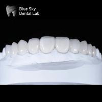 Buy cheap Sleek Premium Veneer Cases 0.3mm Ultra Thin Emax Veneers product