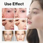 Hot Selling 7% Glycolic Acid Exfoliating Toner Acne Removal Face Skin Care Toner