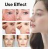 Buy cheap Hot Selling 7% Glycolic Acid Exfoliating Toner Acne Removal Face Skin Care Toner Private Label Glycolic Exfoliating Toner from wholesalers