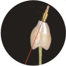 Wholesale Natural ASC Angled Screw Channel Dental Implants Crown from china suppliers