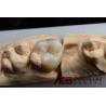 Buy cheap Strong Biocompatible Dental Composite Ceramic Inlay And Onlay Restorative Services from wholesalers